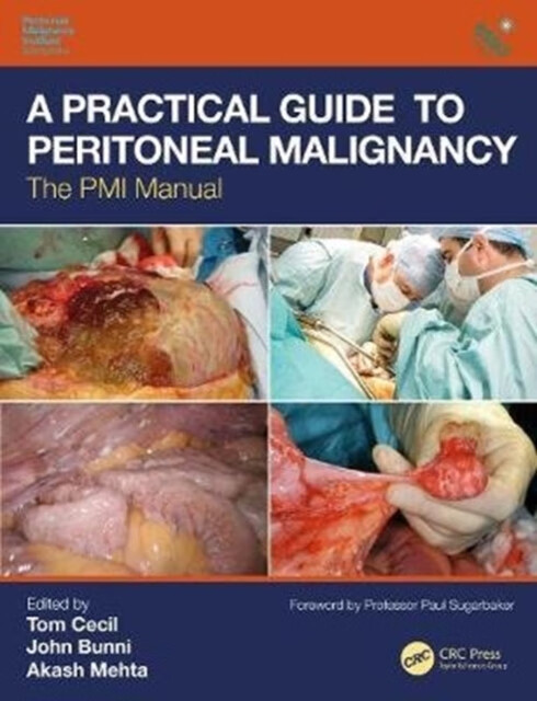 预订 a practical guide to peritoneal malignancy