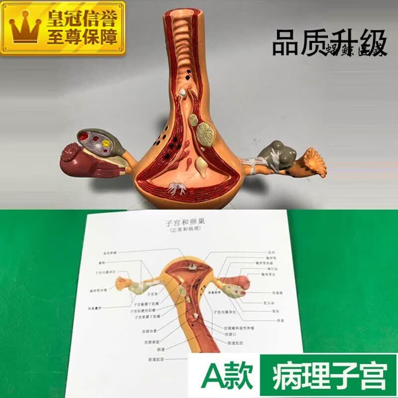 【京健康】人体子宫模型教具模具阴道卵巢解剖病理医学女性仿真女 a款