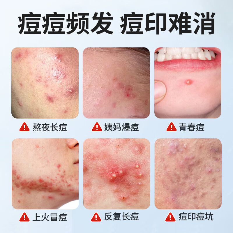 H18水杨酸洗面奶男女士控油祛痘去黑头收缩毛孔淡化痘印深层清洁面乳