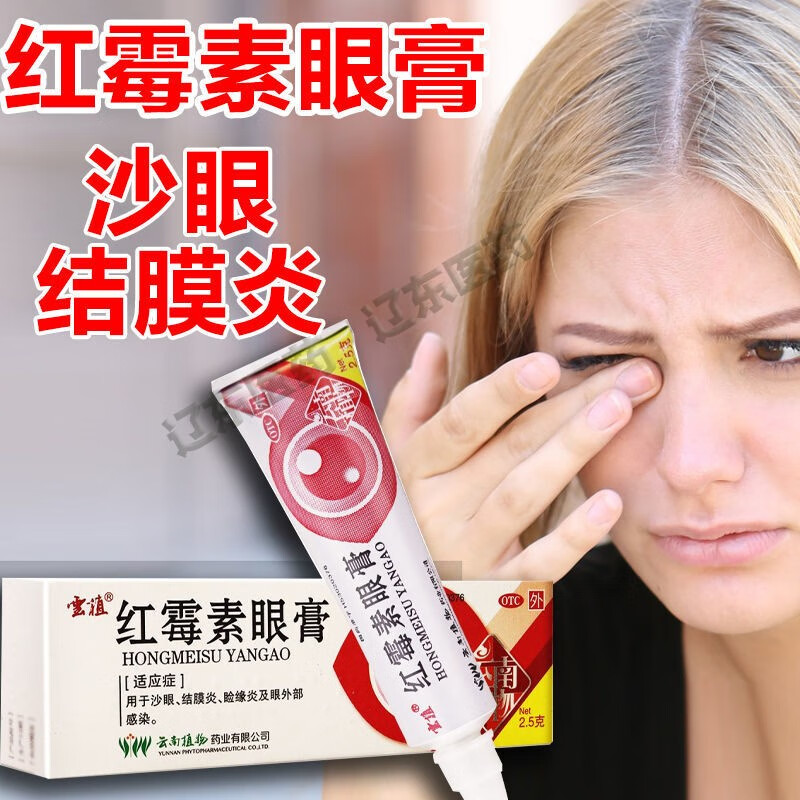 5g治疗沙眼,结膜炎,睑缘炎及眼外部感染眼药膏国药准字眼睛痒感染消炎