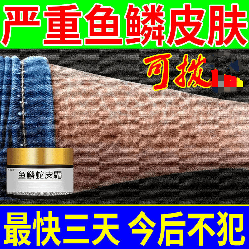 鸡皮肤和蛇的区别(鸡皮肤和蛇的区别图片) 鸡皮肤和蛇的区别(鸡皮肤和蛇的区别图片)