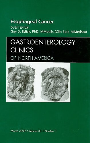预订 esophageal cancer, an issue of gastroenterology clinics