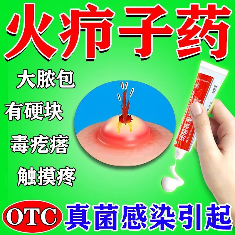 火疖子药膏搭拔毒膏皮脂腺囊肿化脓去脓包专用药膏脖子后面长痘白色