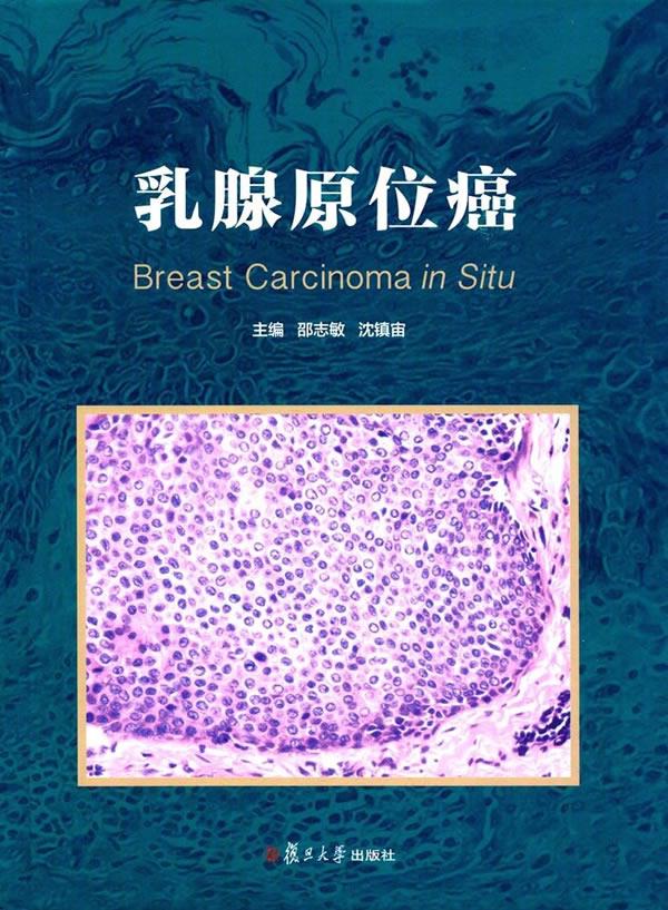 乳腺原位癌 邵志敏,沈镇宙 9787309132526