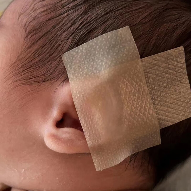 艾妮心新生婴儿儿童爱美耳夹硅胶耳廓贴非耳朵矫正器耳型环缩耳垂耳