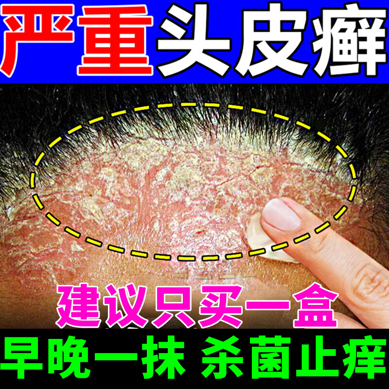 用药 克霉唑乳膏 2支装乳膏【医用级】搭毛囊炎洗发水主图视觉特效