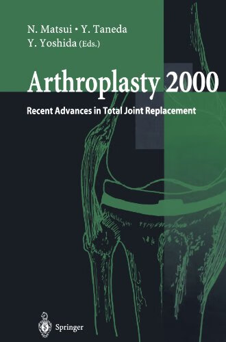 预订 arthroplasty 2000