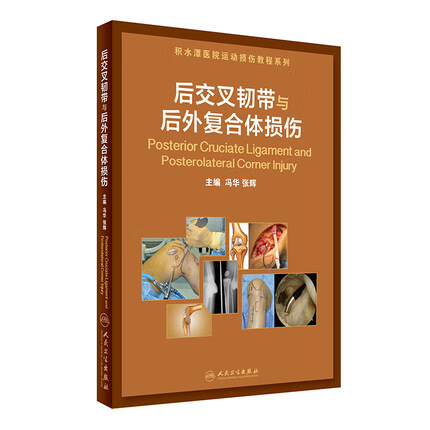 正版 后交叉韧带与后外复合体损伤 冯华 张辉主编 人民卫生出版社9787117233576 运动损伤治疗技术 膝关节多发韧带损伤修复指南