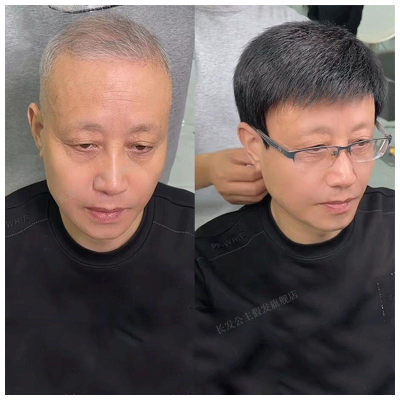 假发男全头套式中老年短发遮盖白发光头真发逼真自然男士假发透气 全真发-手织仿真 大码【57-62cm】使用感如何?