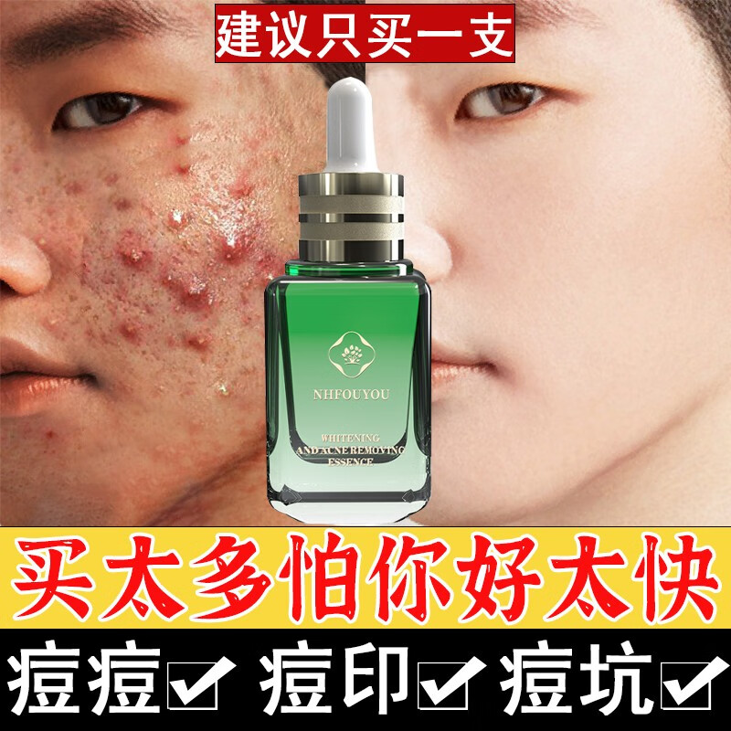 NHFOUYOU祛痘膏淡化痘印痘坑修复男女士改善粉刺闭口去痘痘和痘印 一盒【三盒一周期】买2盒 發3盒