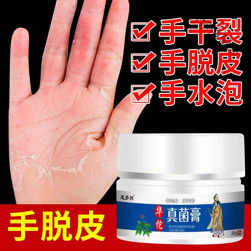 治l手l癣足l癣手足脱l皮水泡皮肤干燥粗l糙开l裂皮l炎湿l疹皮肤瘙l痒