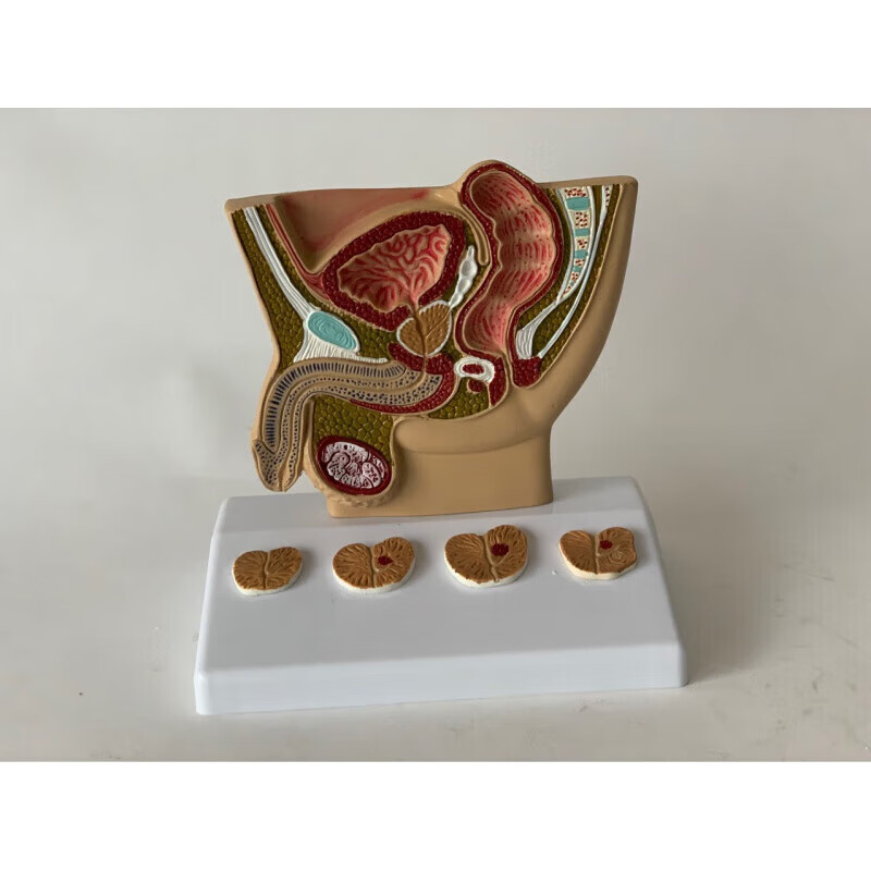 人体男性腹腔膀胱健康病态比较医用教学医患讲解模型