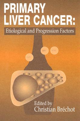 预订 primary liver canceretiological and progression factors