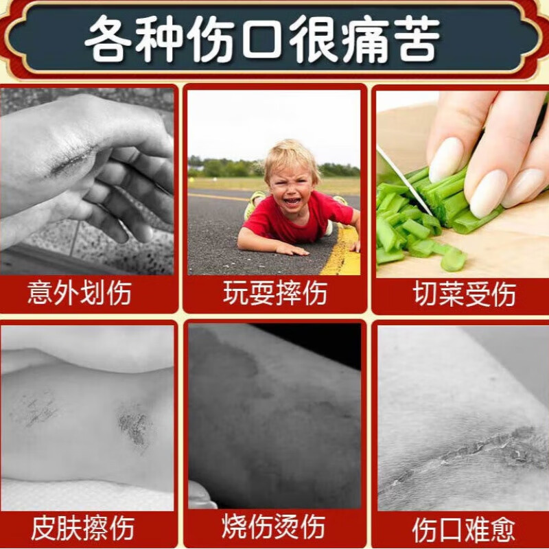 伤口愈合促进长肉外伤擦伤快速结痂止疼感染化脓手术敷料伤口促进 单