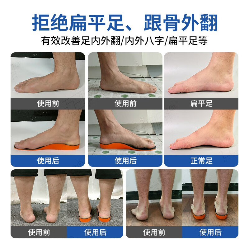 足峰3D定制扁平足矫正鞋垫足弓支撑垫XO型腿内八字纠正缓解足底筋膜炎 第十代-3D雕刻(负离子升级五合一)皮面绿 成人儿童一对一取模对症定制(多功能矫正鞋垫)一双