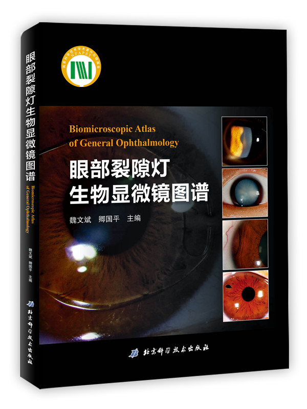 眼部裂隙灯生物显微镜图谱 医学 魏文斌 卿国平 北京科学技术出版社 9787530488607