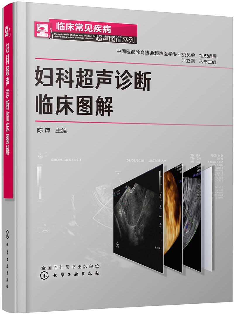临床常见疾病超声图谱系列--妇科超声诊断临床图解