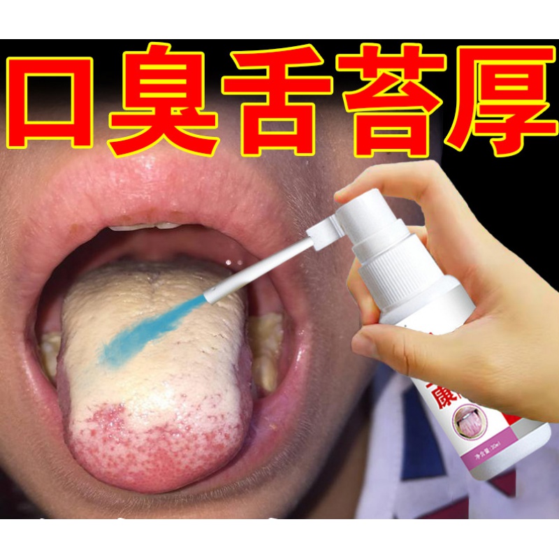 舌苔厚白口臭的调理舌苔白厚口臭调理口干发黄口腔清新喷雾去1除1治