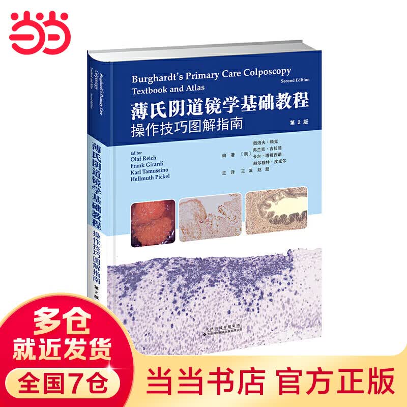 薄氏阴道镜学基础教程：操作技巧图解指南