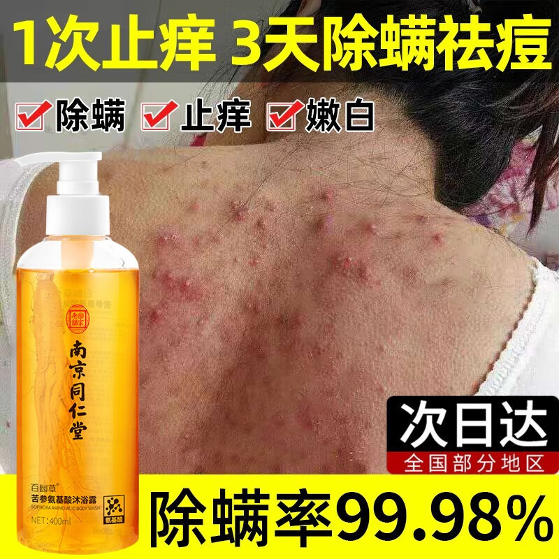 南京同仁堂去螨清痘除螨沐浴露去螨虫痘痘鸡皮肤角质控油液体男女沐浴