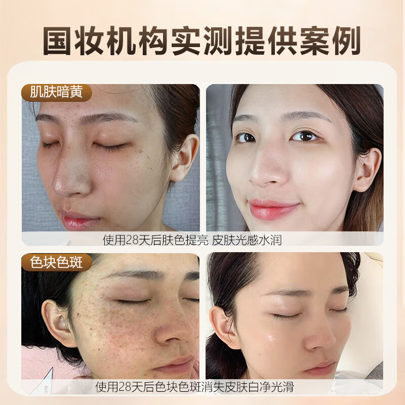 【医I美院线】氨甲环酸精华液传明酸湿敷注射液黄褐斑美白祛斑提亮肤色改善暗沉补水保湿烟酰胺原液小白瓶O 三瓶装【溶斑油不反黑】