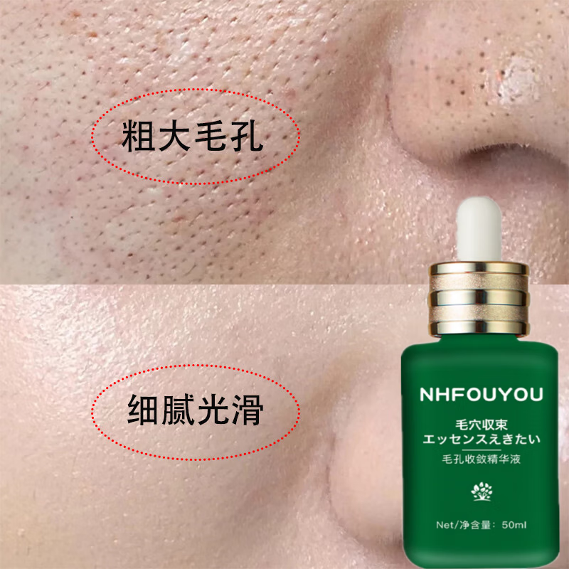 NHFOUYOU毛孔收缩毛孔精华液去黑头毛孔粗大闭口粉刺敏感肌草本优子 【轻微毛孔】1瓶装+赠品