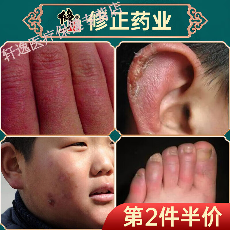 冻疮膏冻伤膏儿童手足耳朵脸部脚后跟皲裂膏干裂蛇油膏红花冻康膏宝宝
