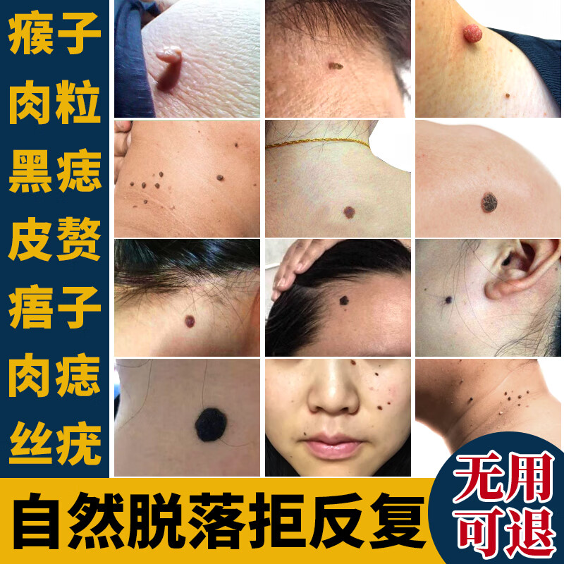 皮肤用药 维a酸乳膏 1盒