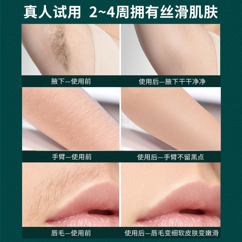 RIX 脱毛仪冰点蓝宝石激光脱毛 男女士 家用脸部唇部腋下腿毛汗毛私密处剃毛仪器 新款男女通用琉光白(医用级冰感不留黑+紧致嫩肤)