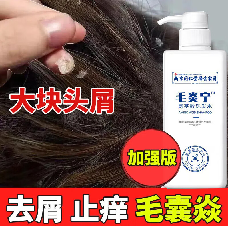 水毛炎宁洗发水除i螨去屑止i痒螨虫煤 一瓶500ml【轻度头皮的选择】