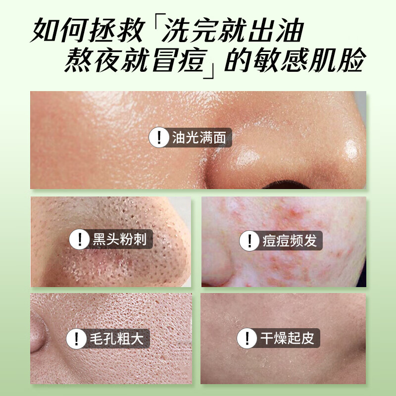 姿珂莱（ZIKE UP FOR L'OR）积雪草氨基酸洗面奶女男士痘痘控油深层清洁去油黑头保湿洁面乳