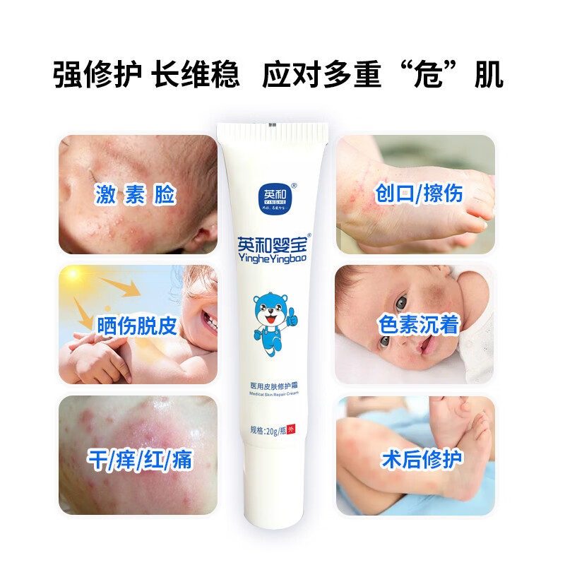 英和(YINGHE)英和婴宝医用皮肤修护霜宝宝湿痒膏皮肤瘙痒干痒红修护霜擦伤创面护理加速20g 20g
