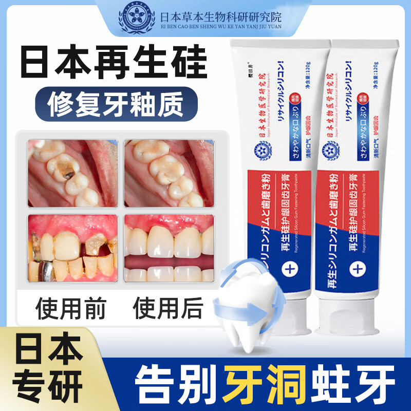 日本再生硅修复牙膏蛀牙牙洞清理儿童牙膏防蛀牙龋齿修复松动专用牙膏