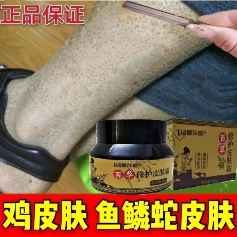 身上起鸡皮疙瘩手摸粗糙(身上起鸡皮疙瘩手摸粗糙疼) 身上起鸡皮疙瘩手摸粗糙(身上起鸡皮疙瘩手摸粗糙疼)