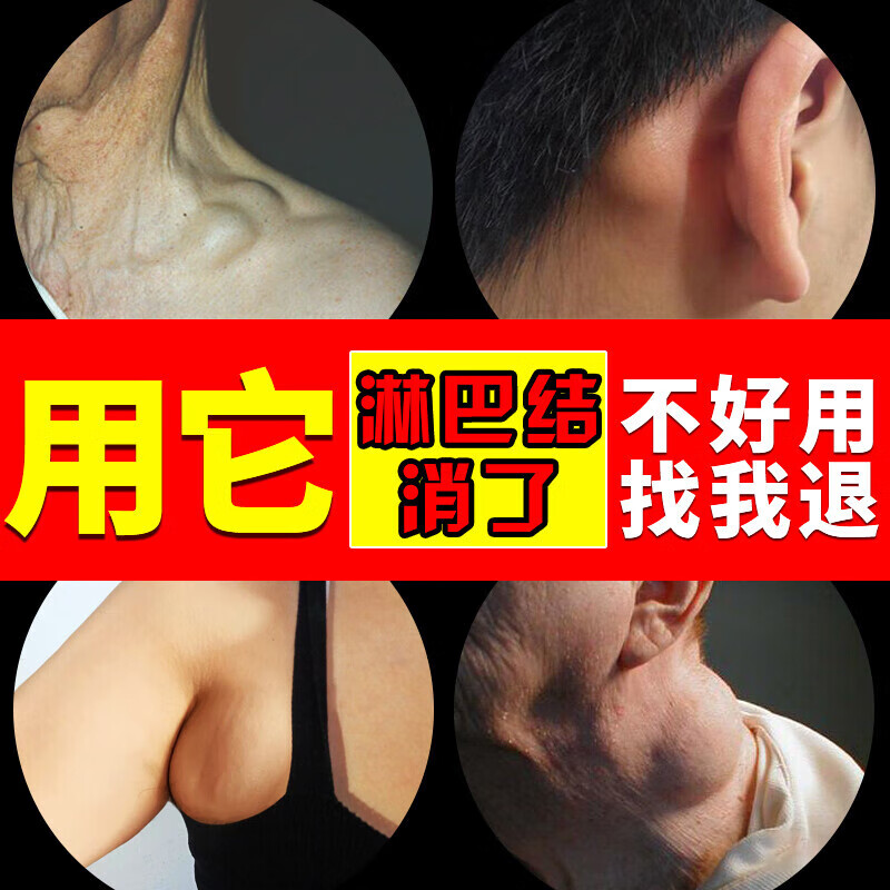 药房直售 药房直售淋巴结消贴颈部 淋巴散结膏淋巴结消贴耳后肿大去