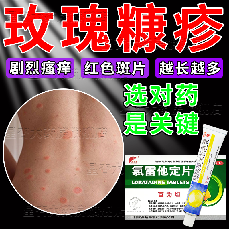 玫瑰糠疹专用药】治皮肤瘙痒皮炎湿疹丘疹型荨麻疹红斑湿疹鳞屑全身痒