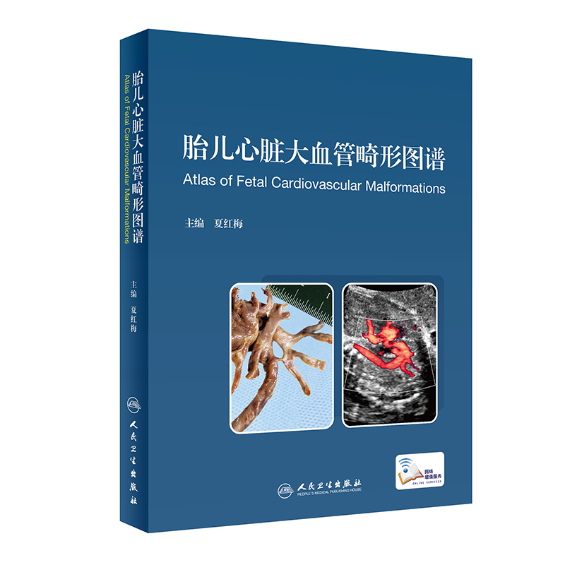 胎儿心脏大血管畸形图谱(配增值)
