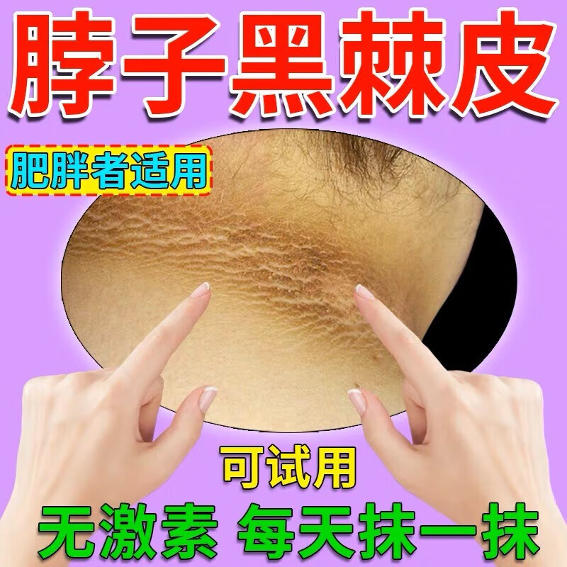 【大药房直发】ftkh黑棘皮病可搭配治脖子全身脸部腋下私处粉嫩淡化黑
