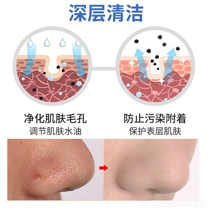 向美博士硫磺洗面奶控油祛痘除螨虫去黑头缩毛孔深层清洁补水保湿洁面乳 2支装【第二支半价,深度清洁】