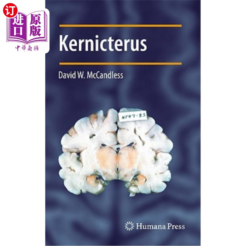 海外直订医药图书kernicterus 核黄疸