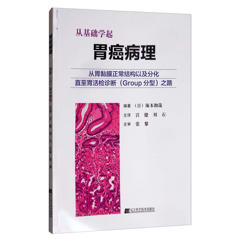 胃癌病理