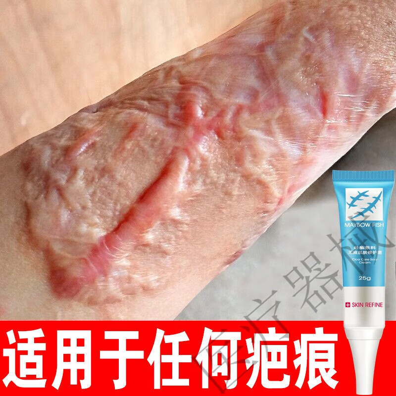 膏修复点痣印痘印去凹凸巴增生剖腹产手术伤疤克星 一盒装(轻度疤痕)