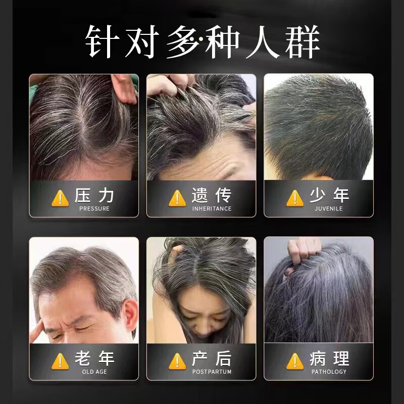 元伊佰草白发治变转乌黑发营养乌发液门店款护理何首乌养发黑发素 买10贈4发14【2洗发液+大礼包】 高配加强门店款【黑发根】