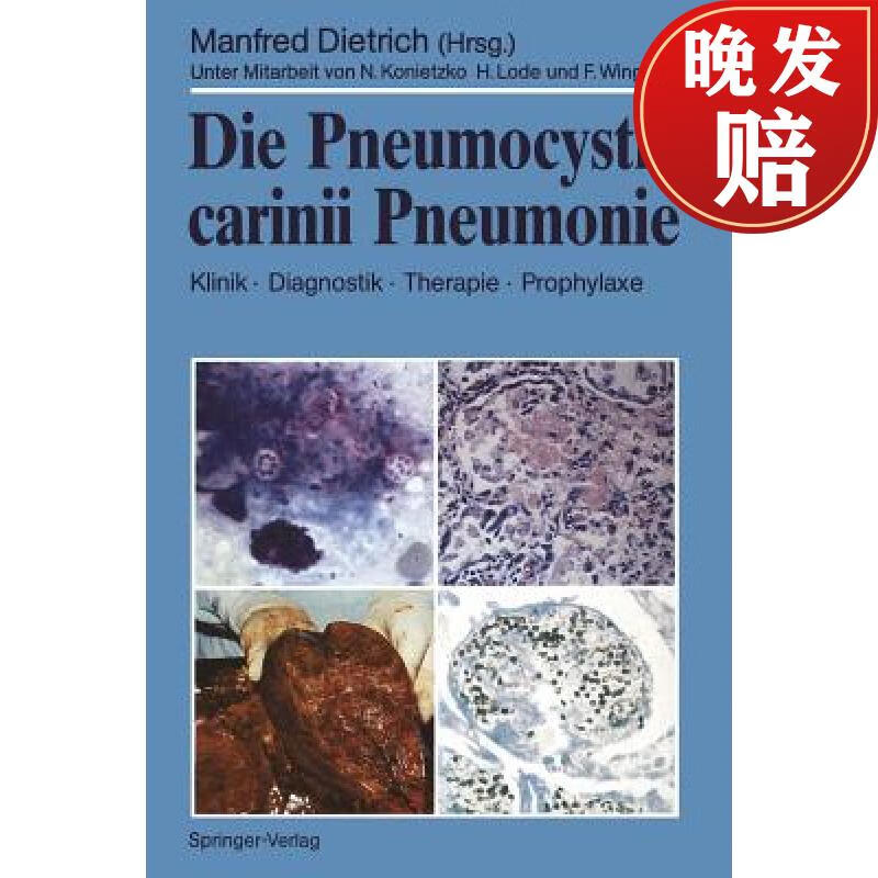 【4周达】die pneumocystis carinii pneumonie: klinik - diagnostik