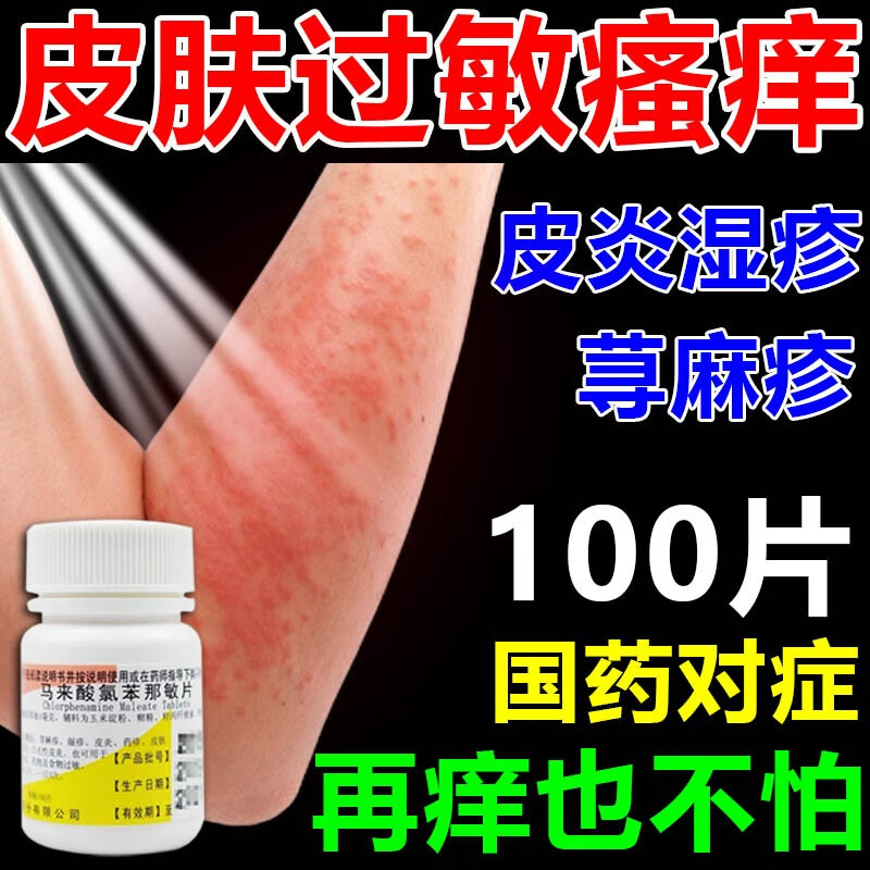 全身痒皮肤瘙痒吃什么药皮炎湿疹 荨麻疹专用药过敏止痒断 皮肤过敏药