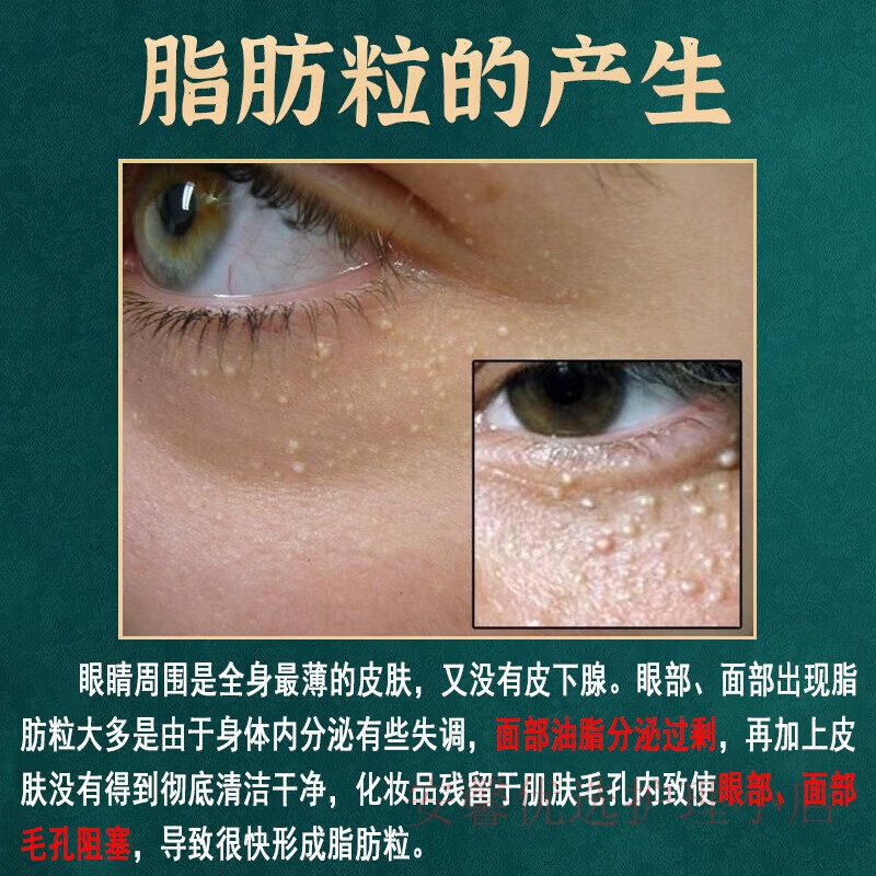 白云山颗粒清肌精华液淡化汗管粒油脂粒补水保湿温和不刺激男女通用 五盒【买3贈2】