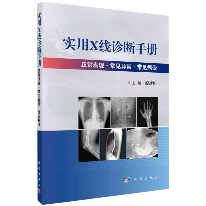 实用X线诊断手册(正常表现常见异常常见病