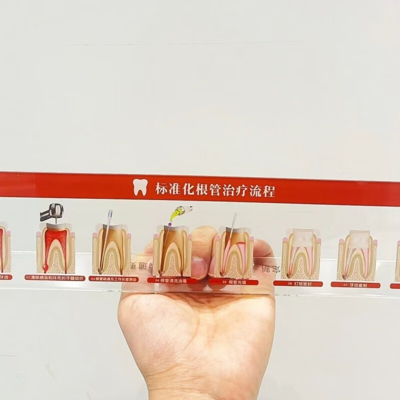 牙科医患沟通工具窝沟封闭根管治疗流程图牙齿模型种植牙沟通工具 根