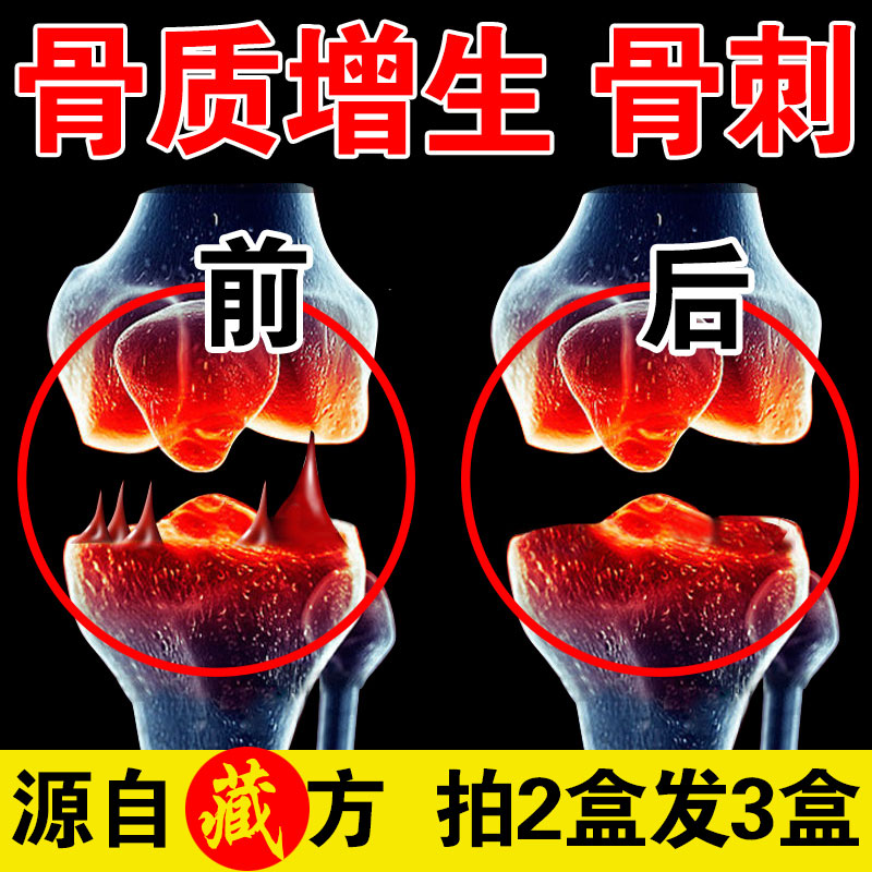 绝佳膏贴(器械)推荐-问德堂骨质增生贴骨刺膏贴