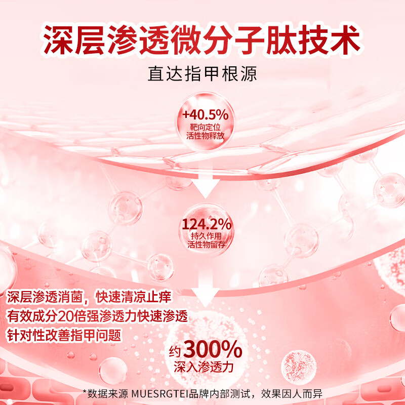 MUESRGTEI德国高端进口灰指甲特殊效去除增厚发黄变空液中草药水灰甲 一盒装【1-2个推荐】
